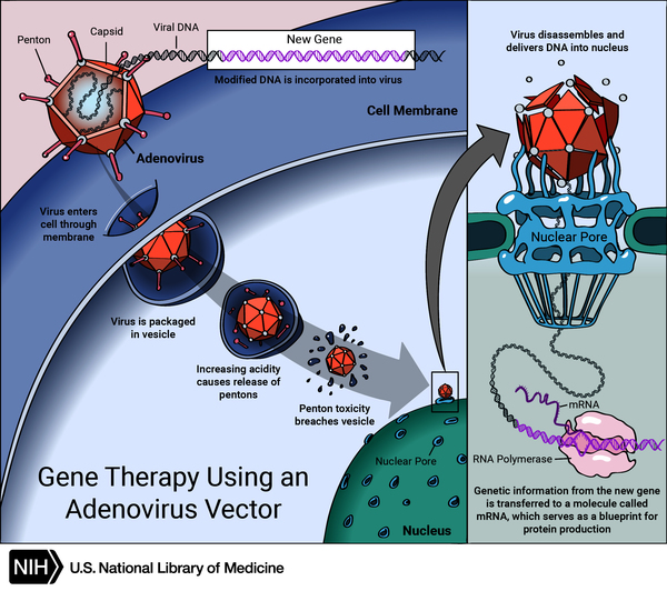 A new gene is inserted directly into a cell. A carrier called a vector is genetically engineered to deliver the gene. An adenovirus introduces the DNA into the nucleus of the cell, but the DNA is not integrated into a chromosome.